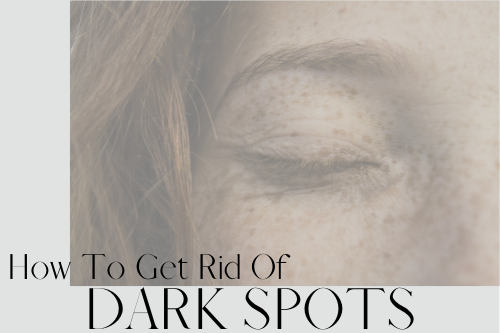 how ot get rid of dark spots