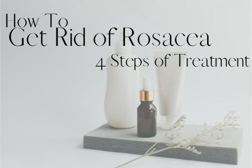 How to get rid of rosacea